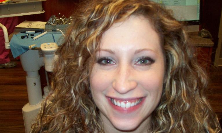 Six-Month-Smiles-After-Image